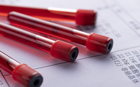 皮肤瘙痒,过敏,潍坊市皮肤病医院