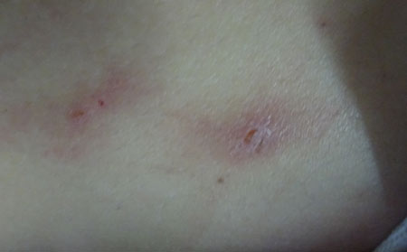 潍坊好的皮肤病医院怎么选